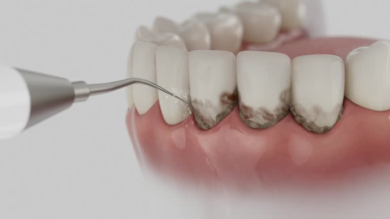 Trusted Tooth Extraction service in Reese, MI - Dentist Open Now